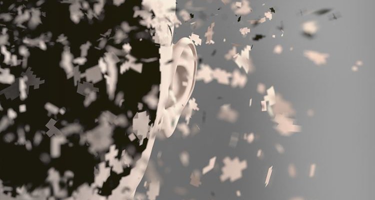 إضطرابات التحويل